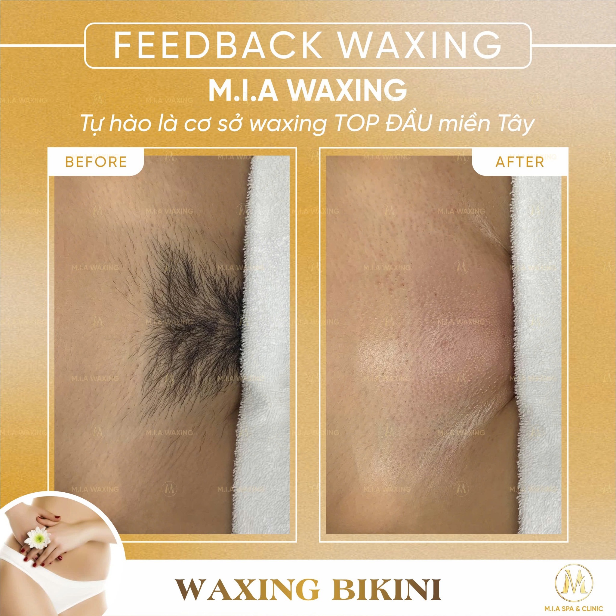 M.I.A Spa - Waxing Cần Thơ ảnh 2