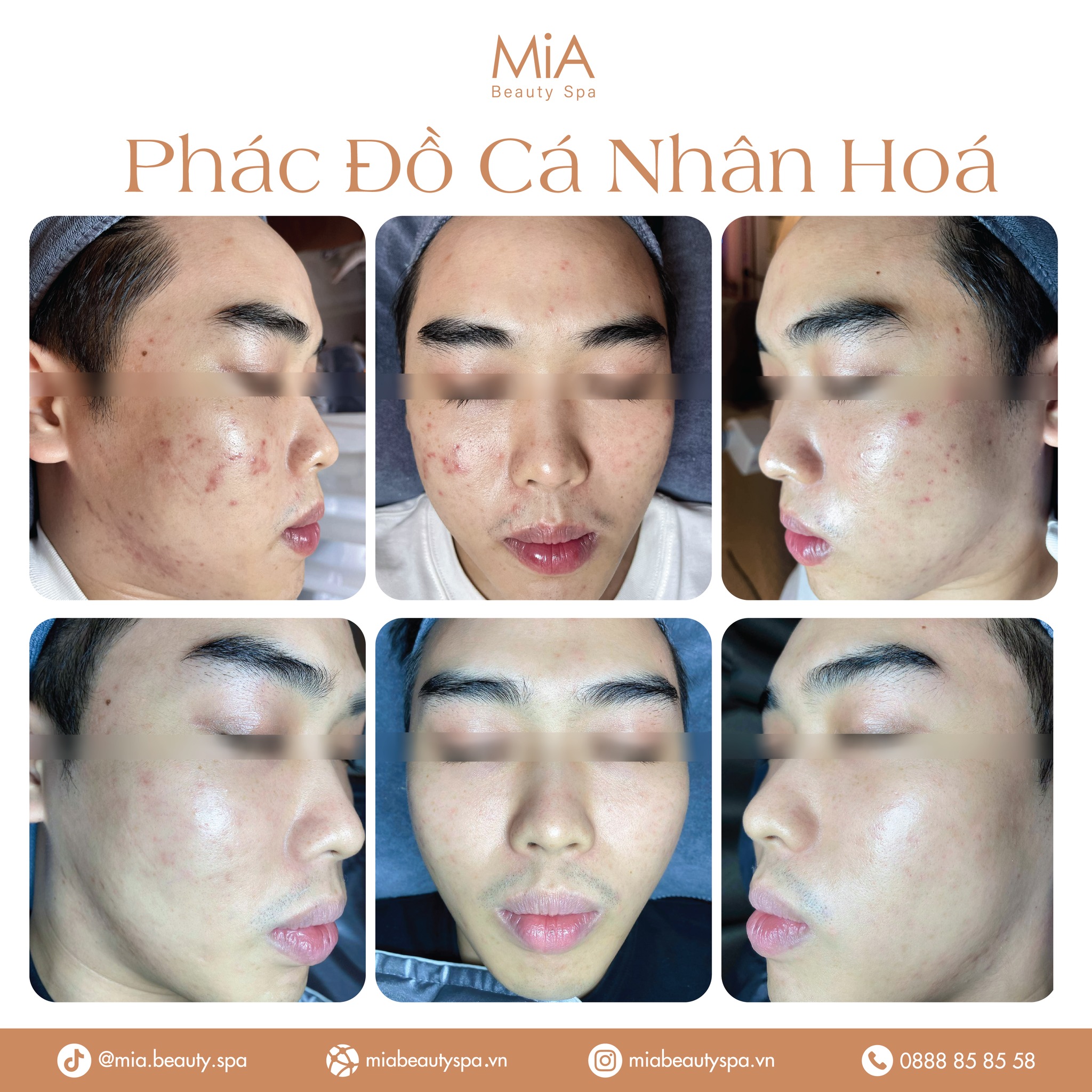 MiA Beauty Spa ảnh 1