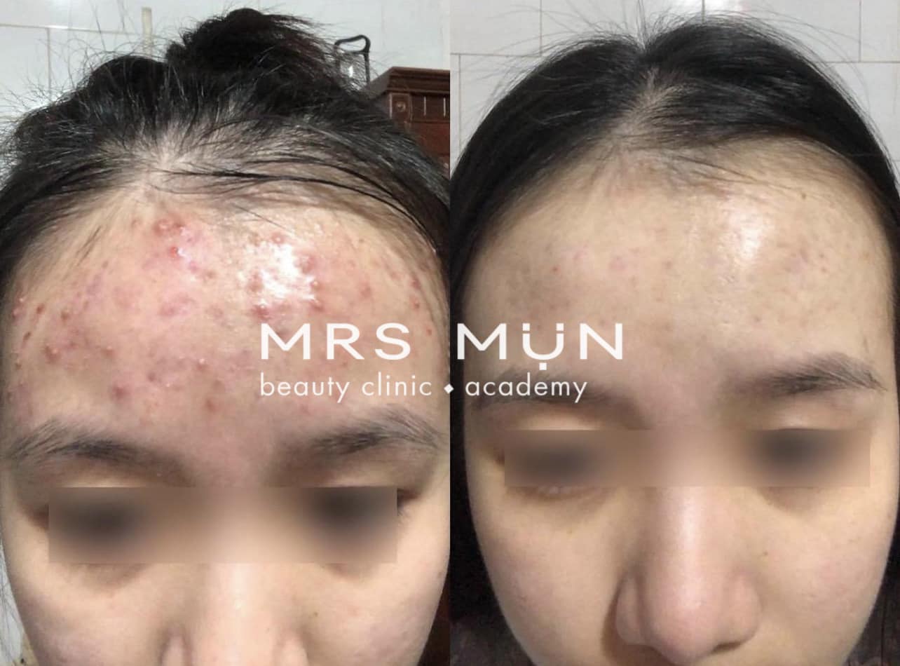 Mrs Mụn Beauty Clinic & Academy ảnh 1