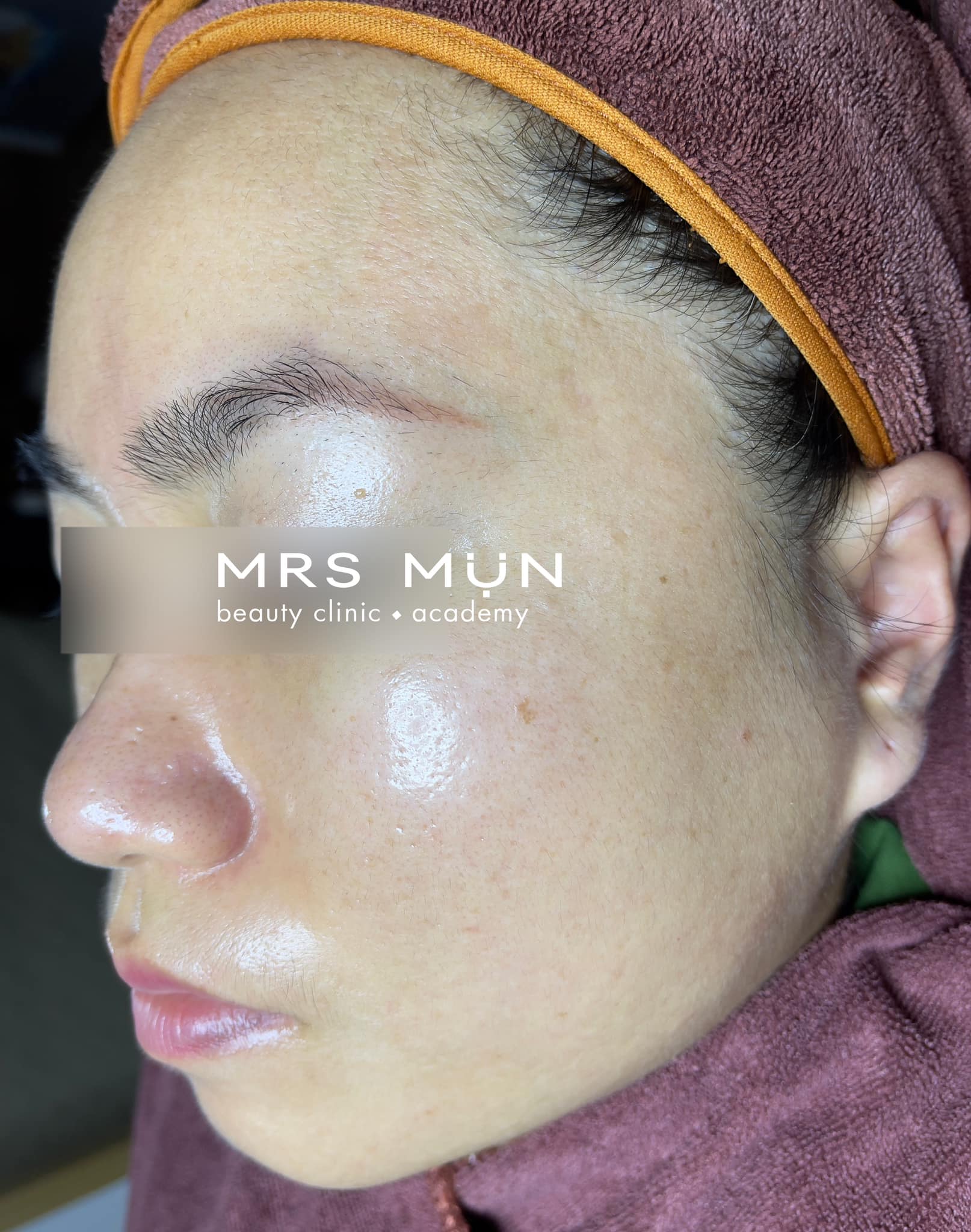 Mrs Mụn Beauty Clinic & Academy ảnh 2