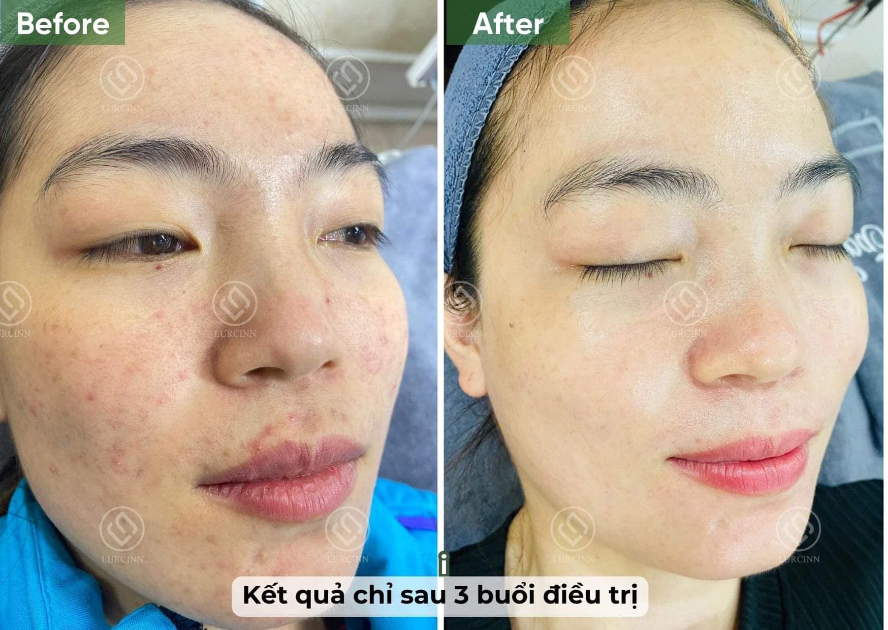 Ngọc Hoan Beauty Spa ảnh 2