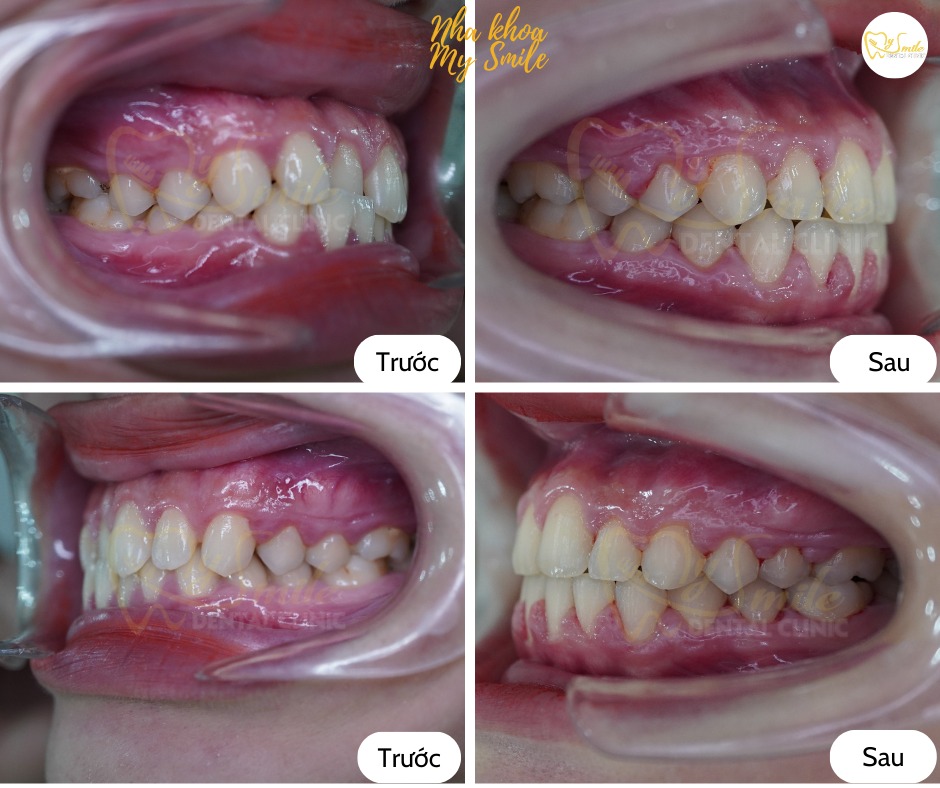 Nha Khoa My Smile ảnh 1