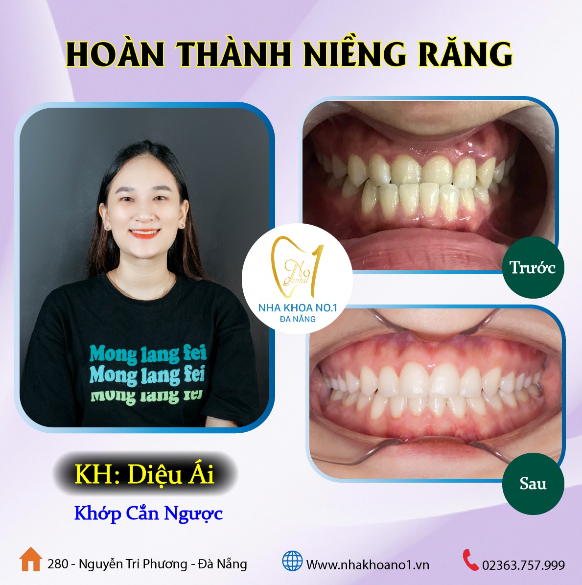 Nha Khoa NO1 Đà Nẵng ảnh 2