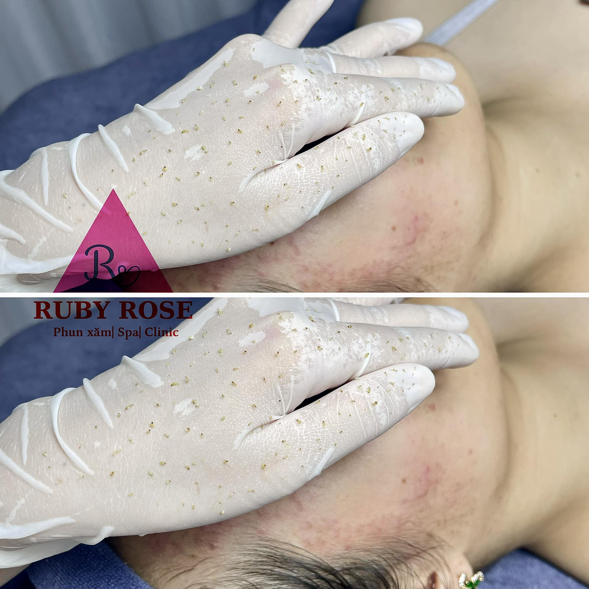 Ruby Rose Spa ảnh 1