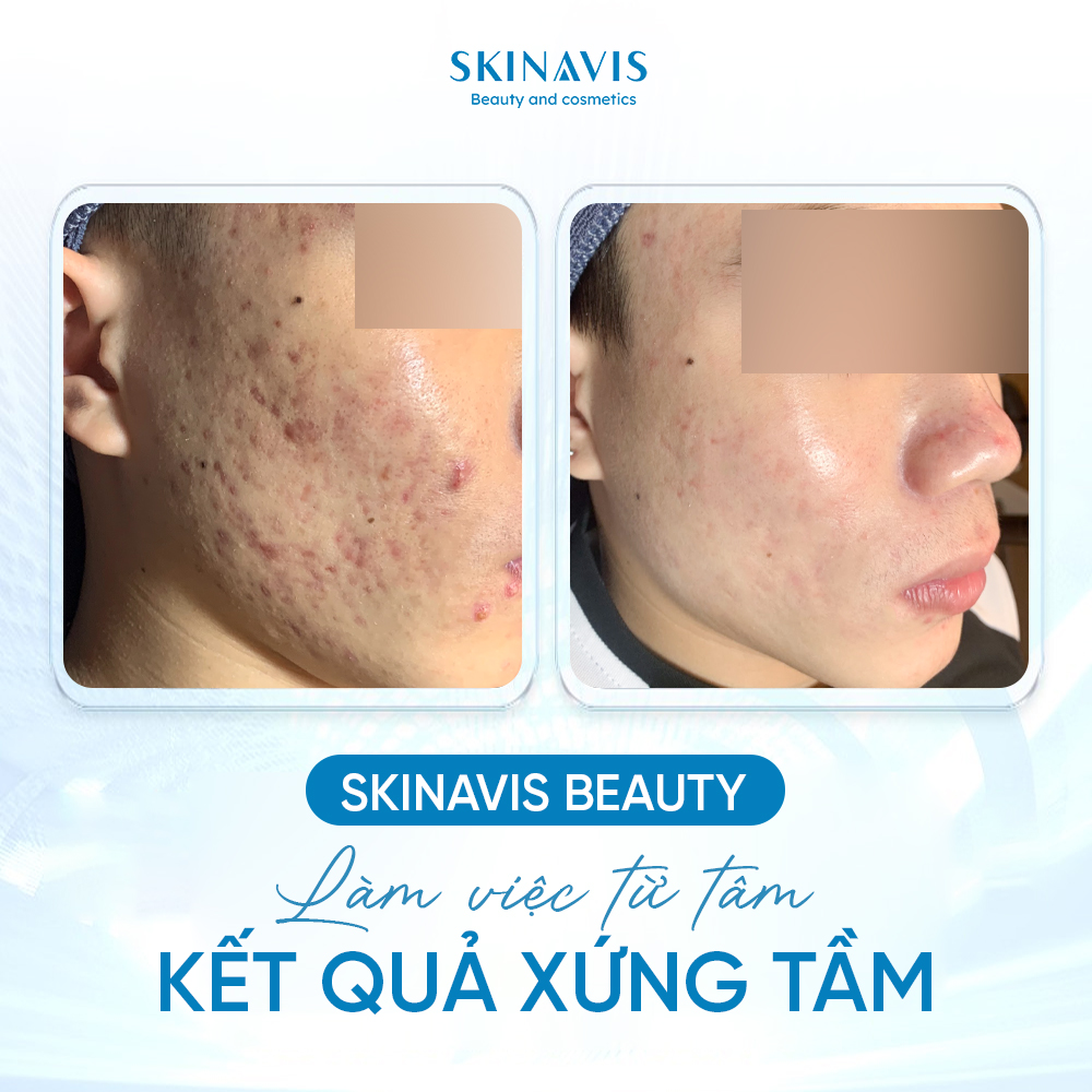 Skinavis Beauty ảnh 1