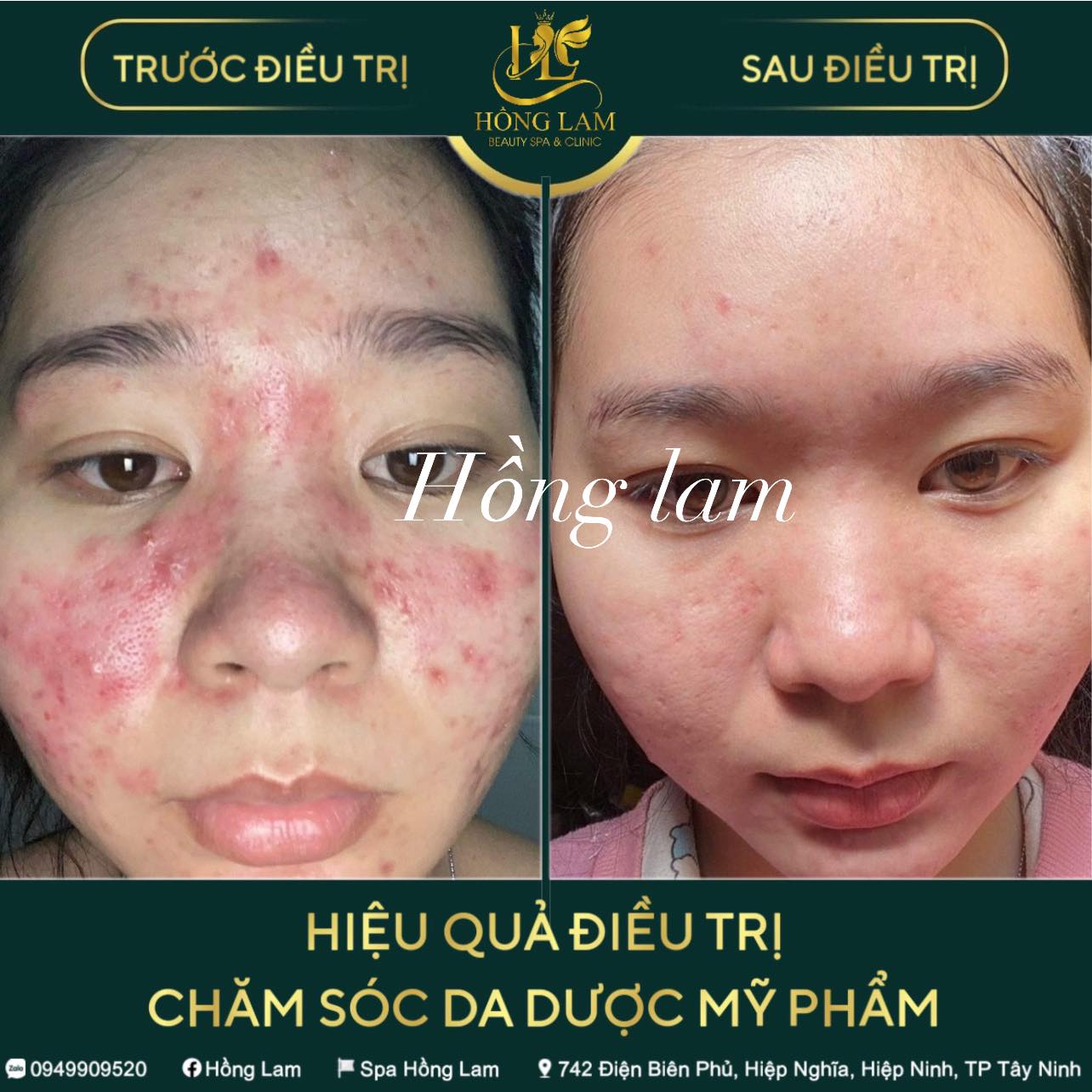 Spa Hồng Lam ảnh 2