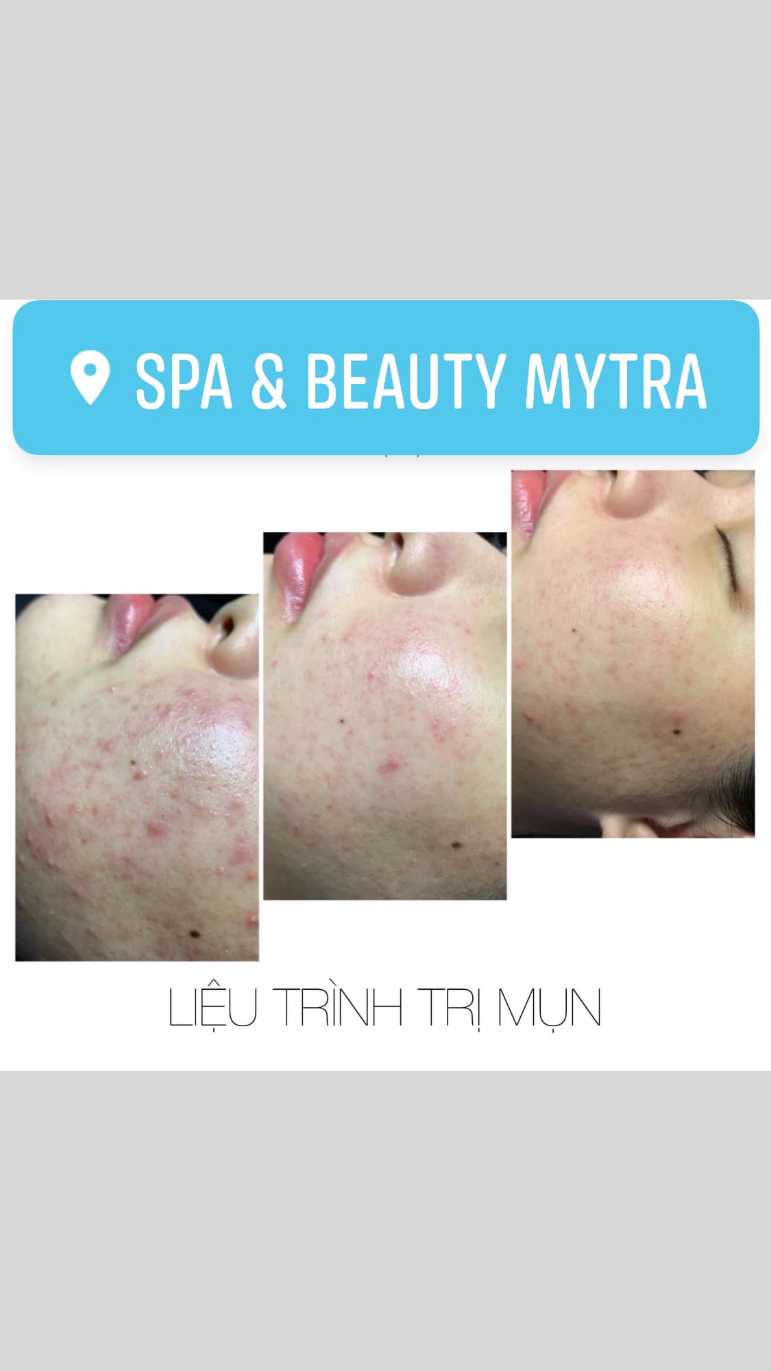 Spa & Beauty MyTra ảnh 2