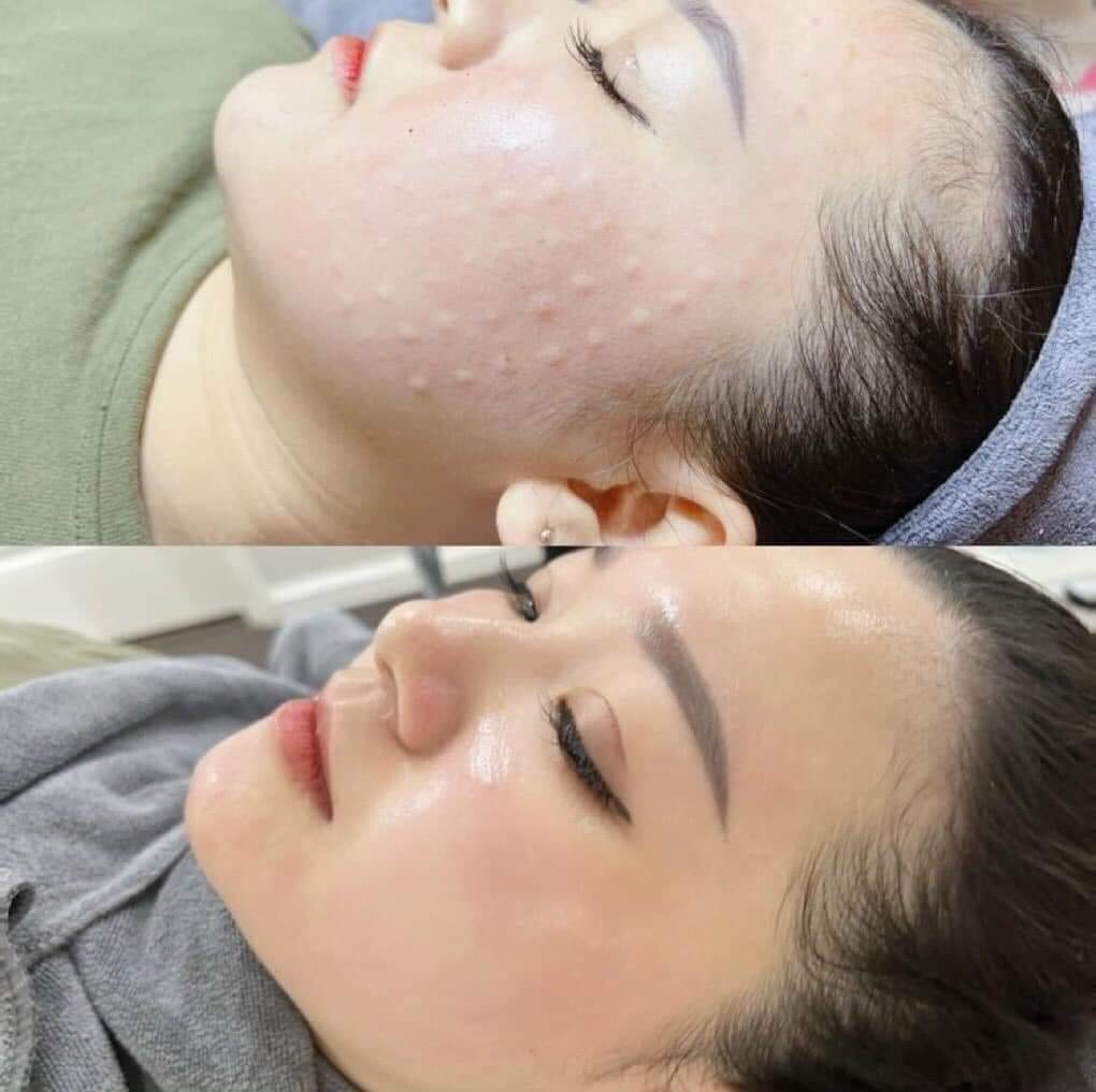 Thẩm Mỹ Viện HaNa Beauty Hà Nội ảnh 1