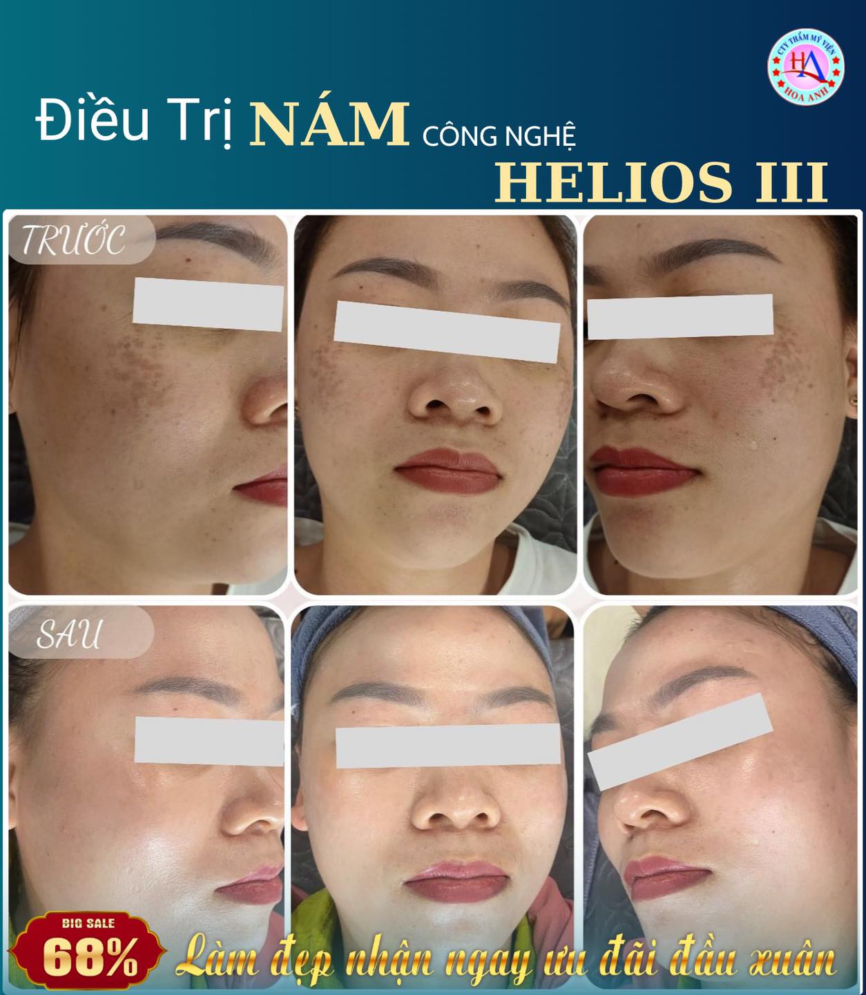 Thẩm Mỹ Viện Hoa Anh ảnh 2