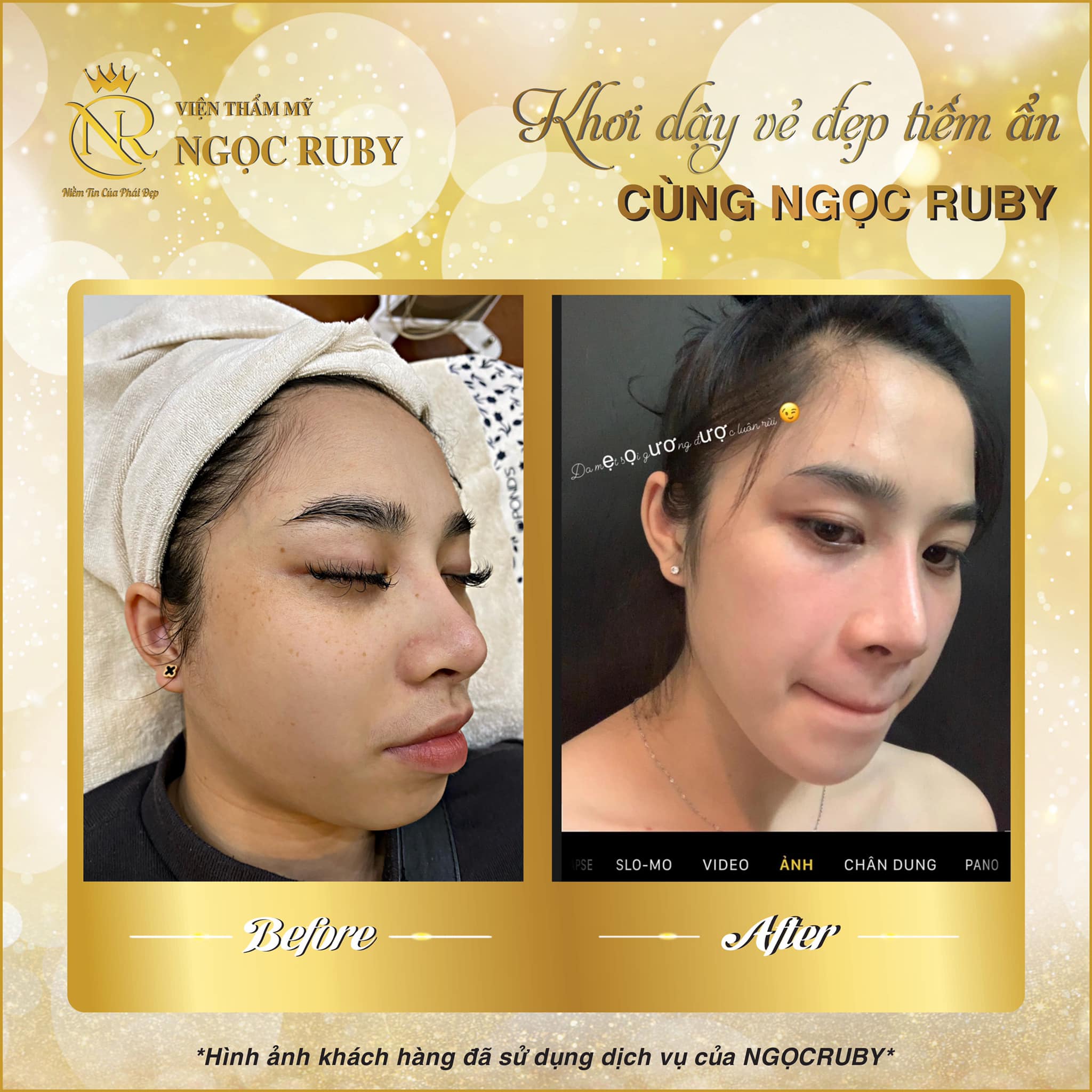 Thẩm mỹ Ngọc Ruby ảnh 1