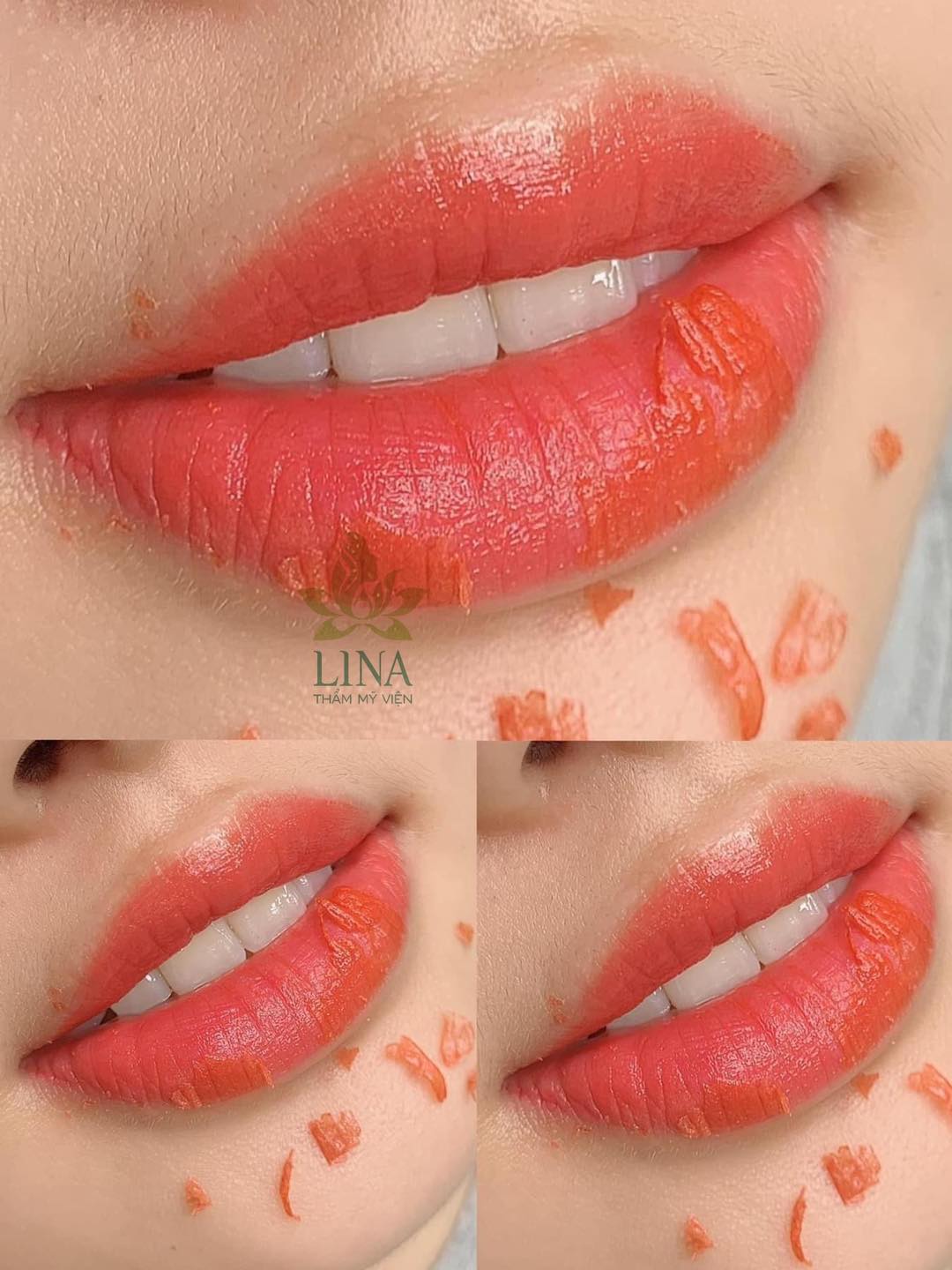 Thẩm mỹ viện Lina ảnh 1