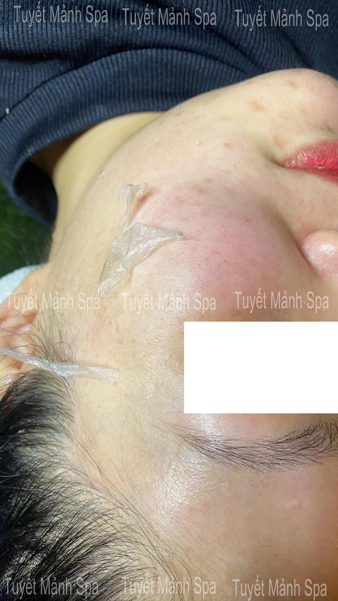 Tuyết Mảnh spa ảnh 2