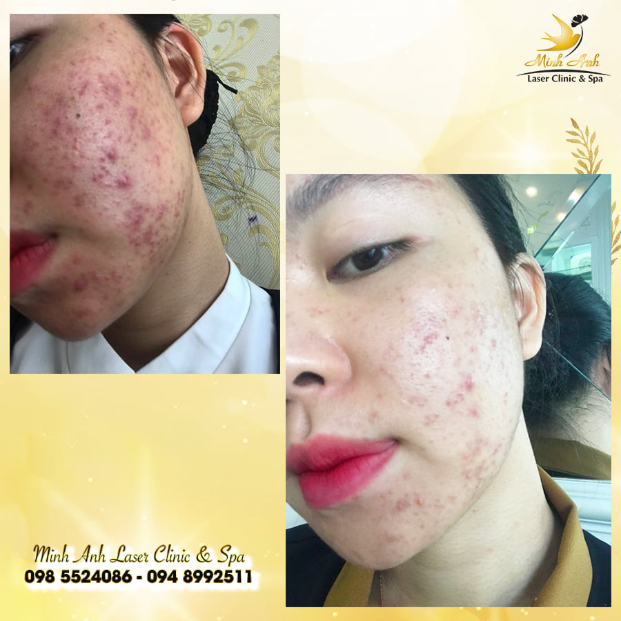 Minh Anh Laser Clinic & Spa ảnh 1