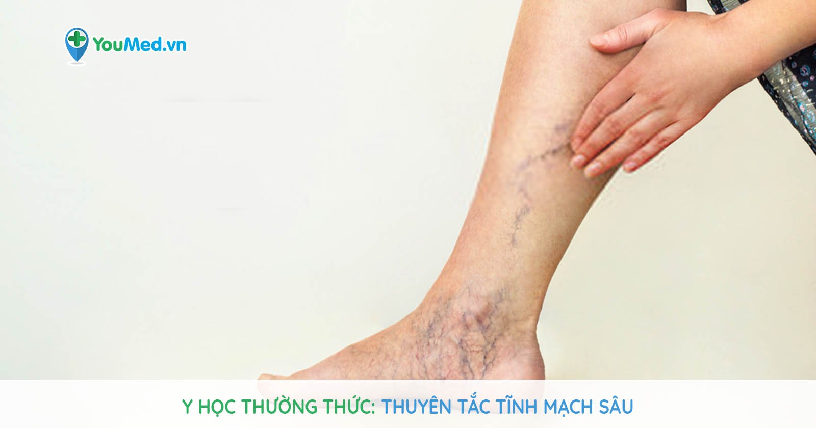 Đau, nặng bắp chân kèm phù bàn chân ảnh 1