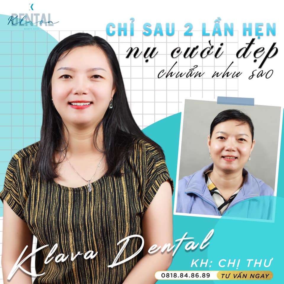 KLAVA Smart Dental ảnh 2