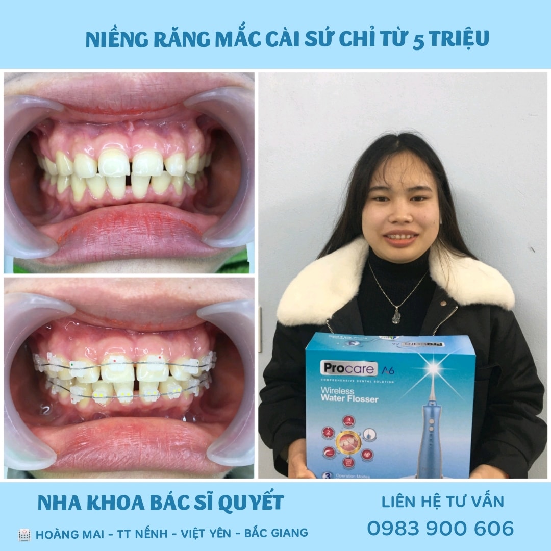 NHA KHOA BÁC SĨ QUYẾT ảnh 1