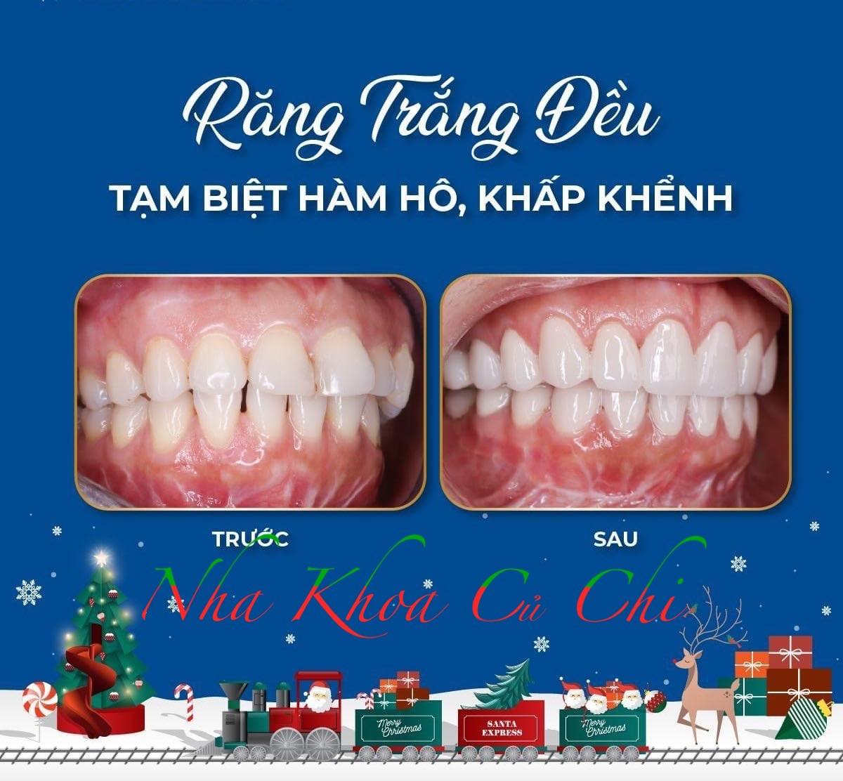 NHA KHOA CỦ CHI ảnh 1