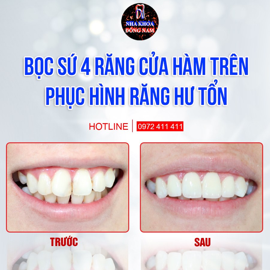 NHA KHOA ĐÔNG NAM ảnh 2