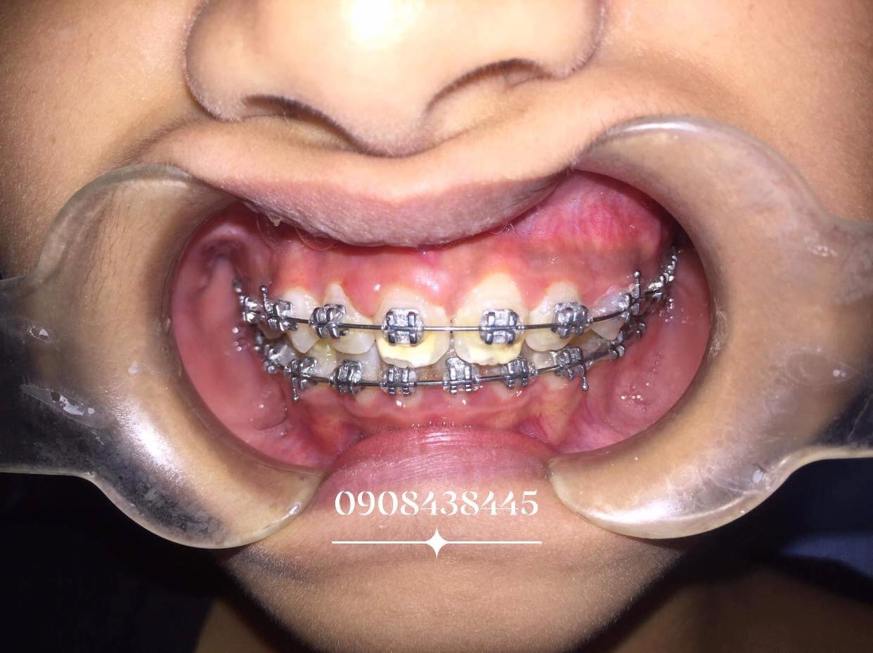 NHA KHOA NHÂN ĐỨC ảnh 1