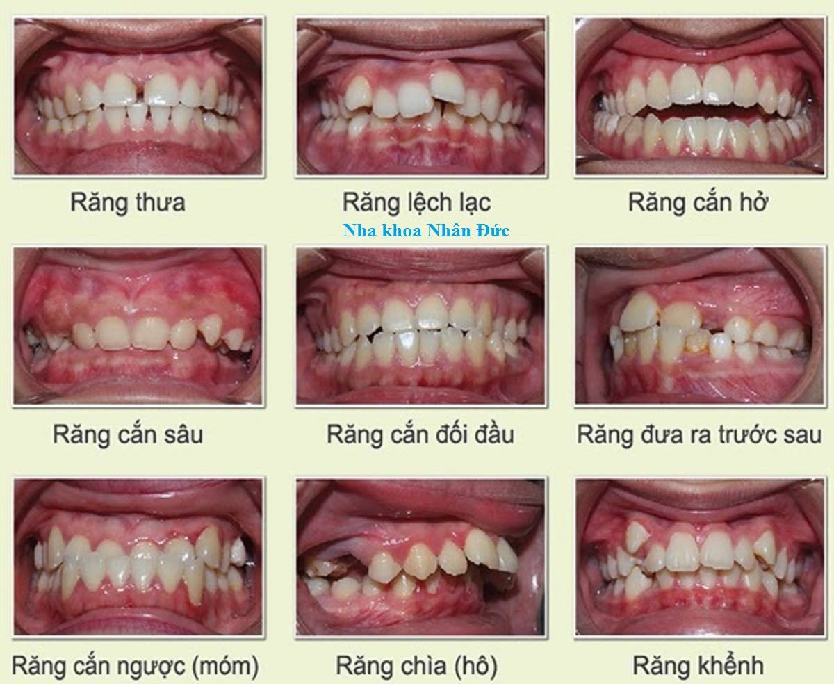 NHA KHOA NHÂN ĐỨC ảnh 2