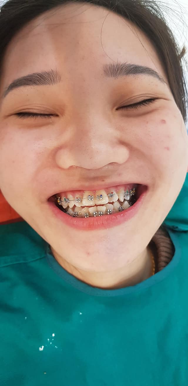 NHA KHOA QUANG TÙNG ảnh 2