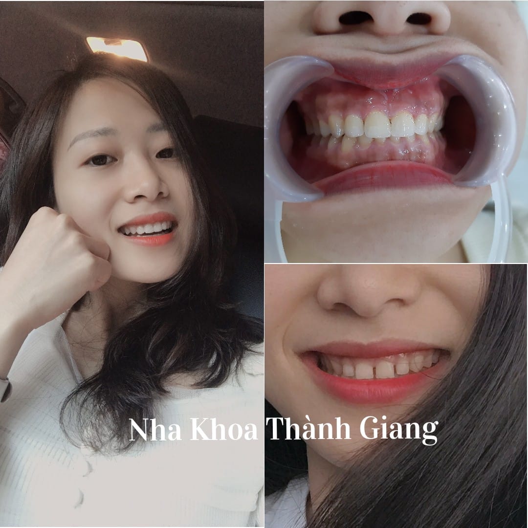 NHA KHOA THÀNH GIANG ảnh 1