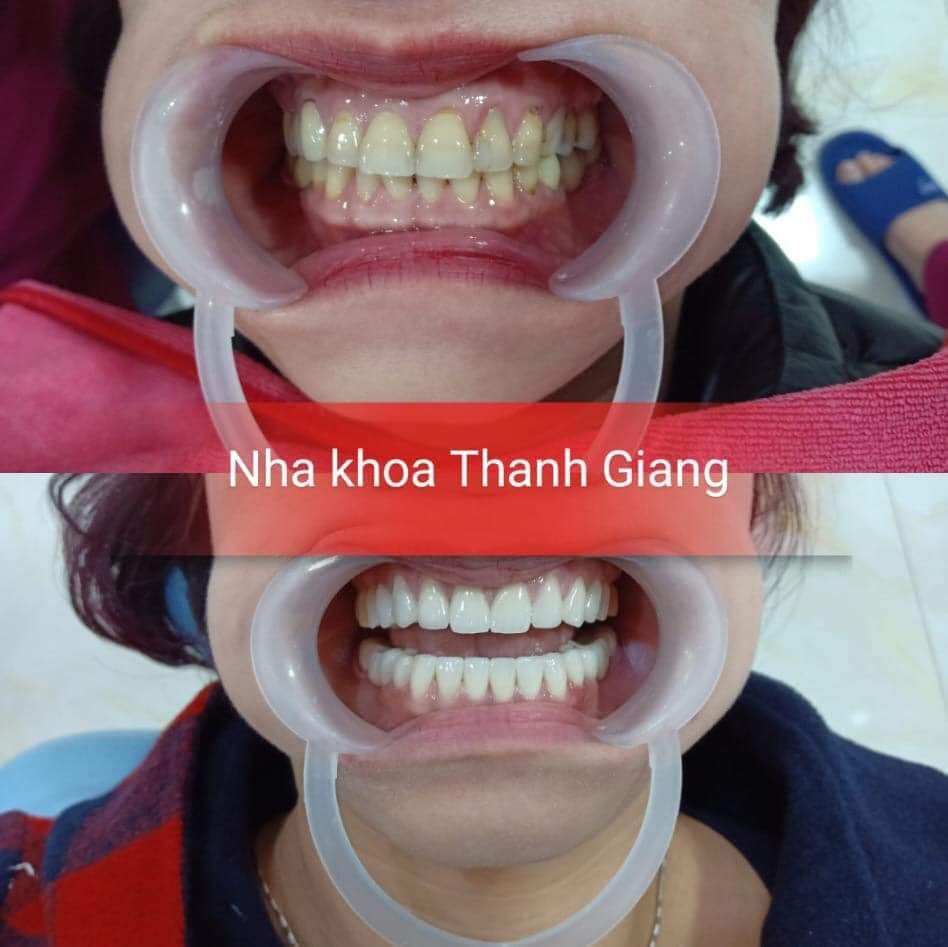 NHA KHOA THÀNH GIANG ảnh 2