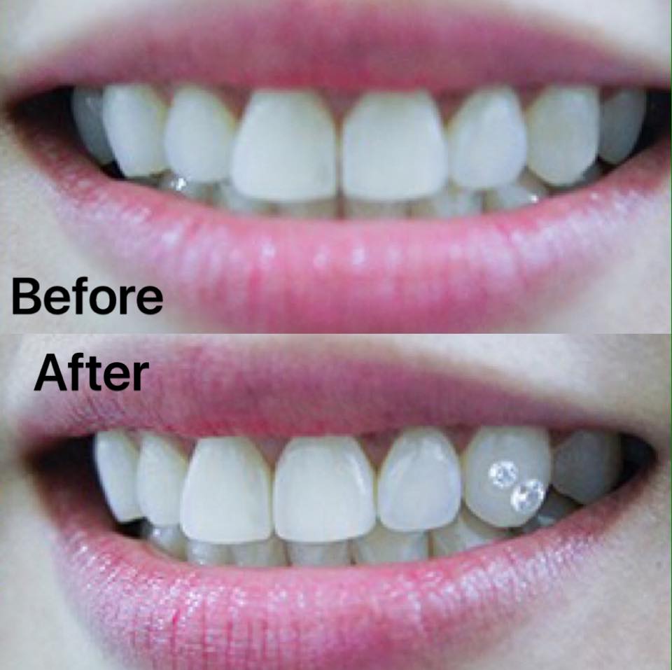 NHA KHOA TOÀN MỸ ảnh 1