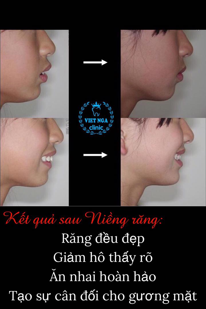 NHA KHOA VIỆT NGA ảnh 1