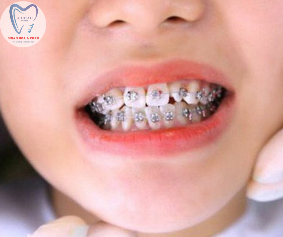 Nha Khoa Á Châu Kon Tum ảnh 2