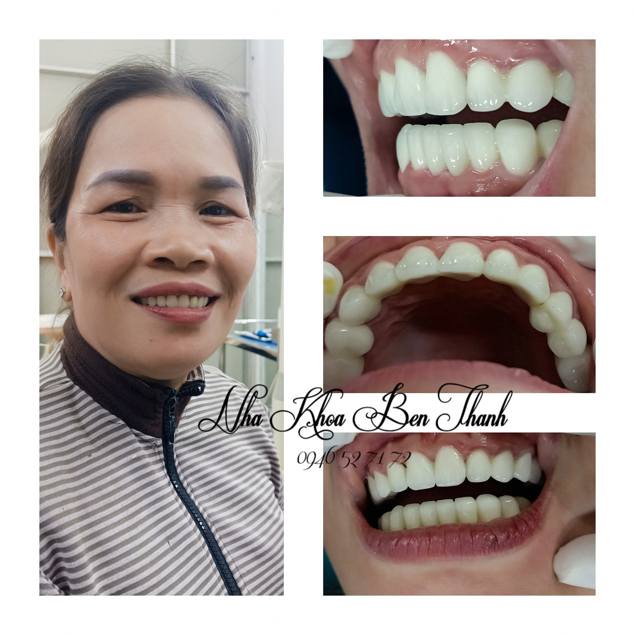 Nha Khoa Bến Thành ảnh 1