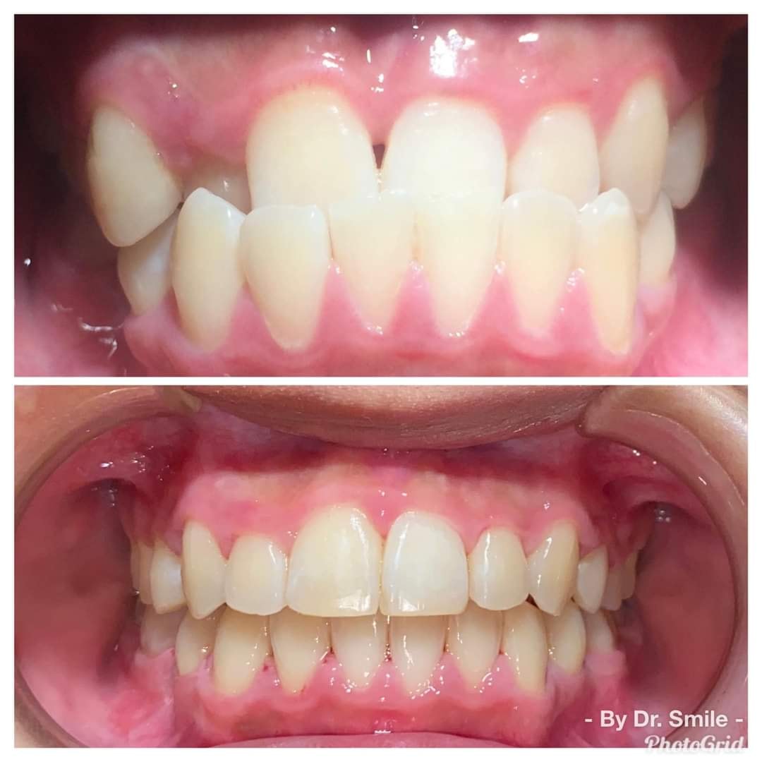 Nha Khoa Dr. Smile Đà Lạt ảnh 2