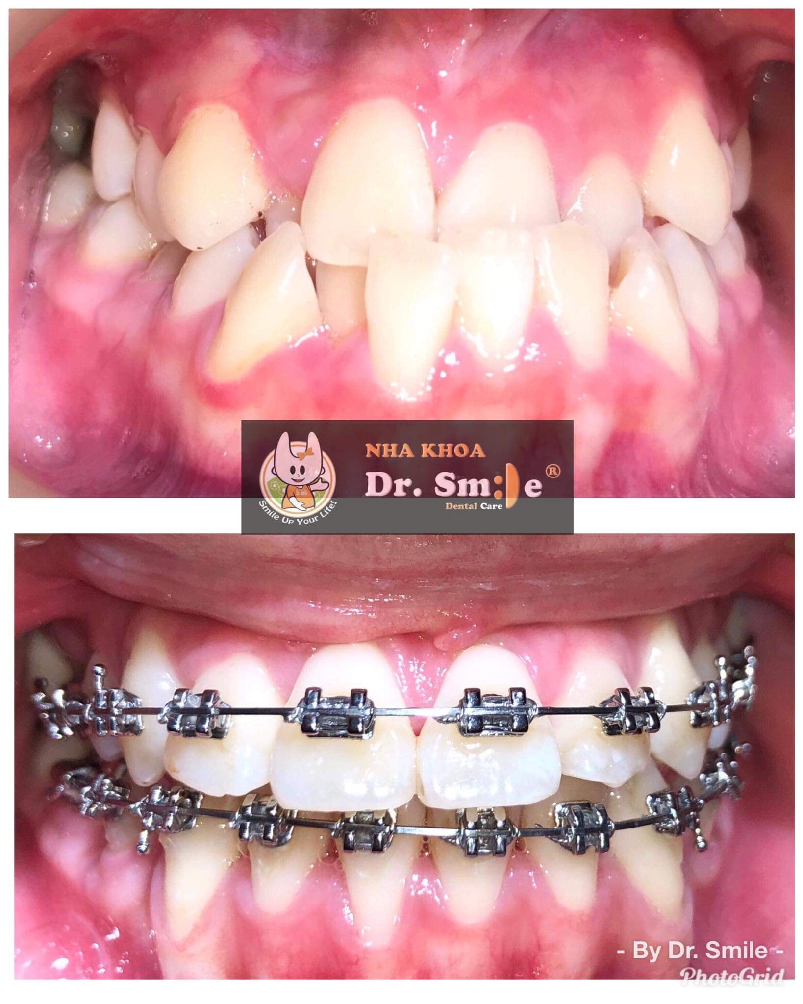 Nha Khoa Dr. Smile Đà Lạt ảnh 1