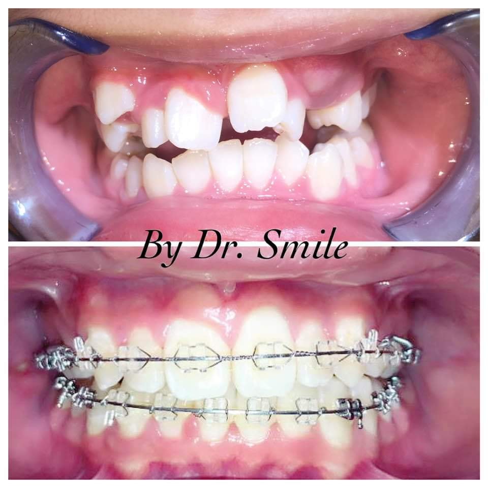 Nha Khoa Dr. Smile Đà Lạt ảnh 2