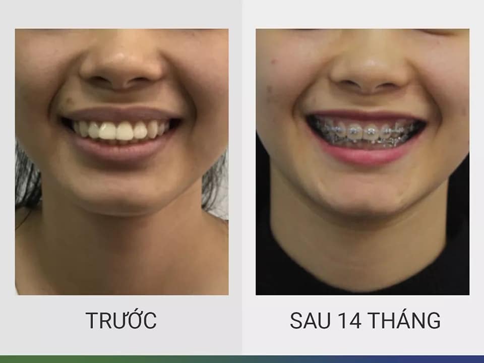 Nha Khoa HẢI ÂU ảnh 1