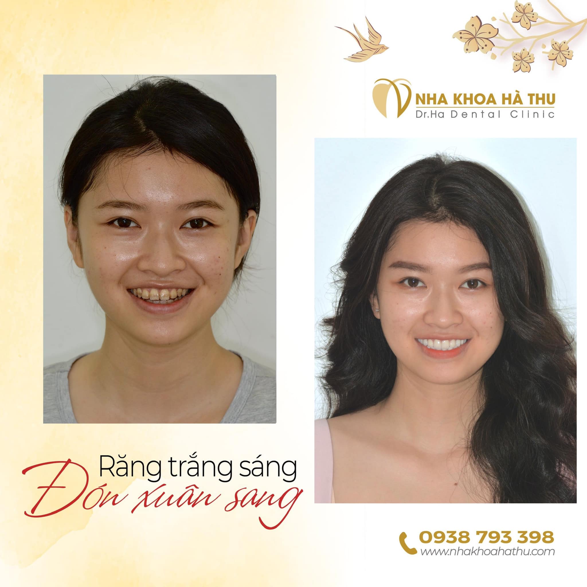 Nha Khoa Hà Thu - Dr.Ha Dental Clinic ảnh 2