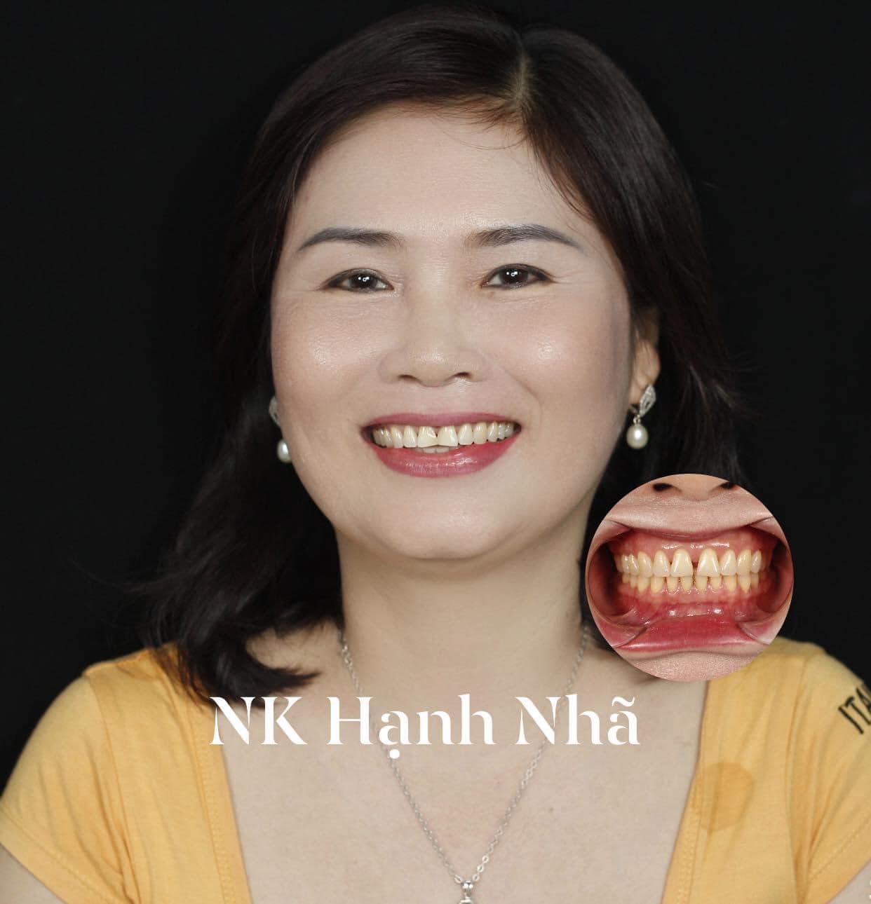 Nha Khoa Hạnh Nhã ảnh 2