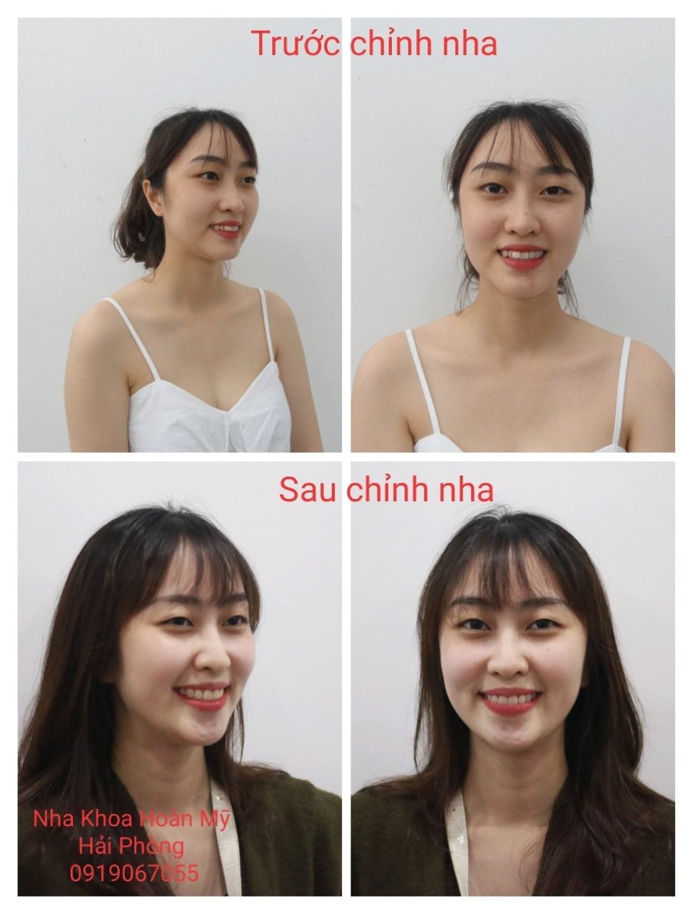 Nha Khoa Hoàn Mỹ Hải Phòng ảnh 1