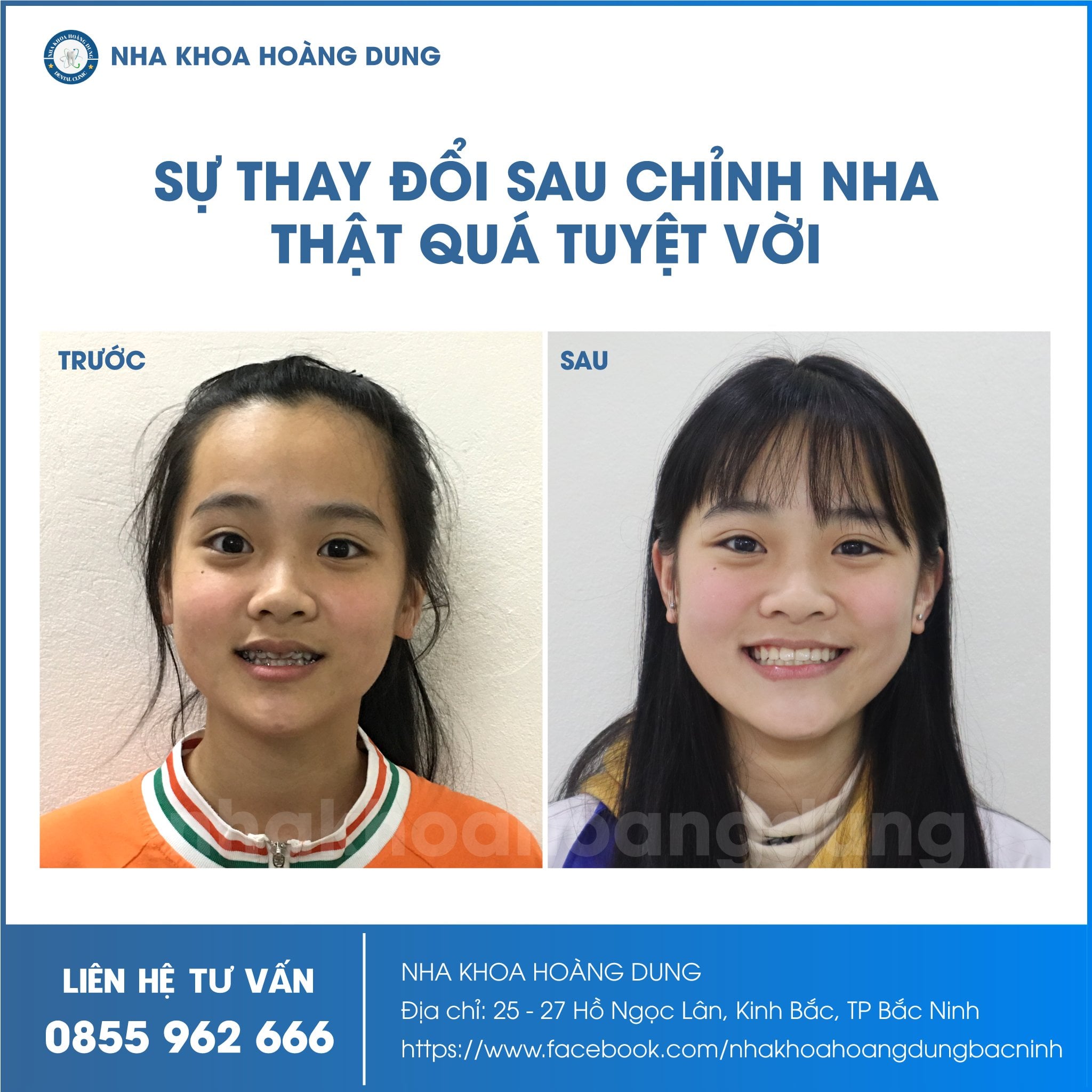 Nha Khoa Hoàng Dung Bắc Ninh ảnh 2