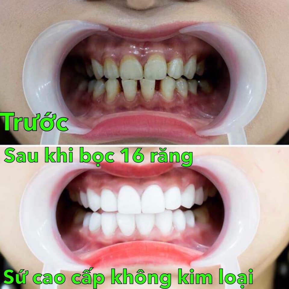 Nha Khoa Hồng Nguyên- Sóc Trăng ảnh 2