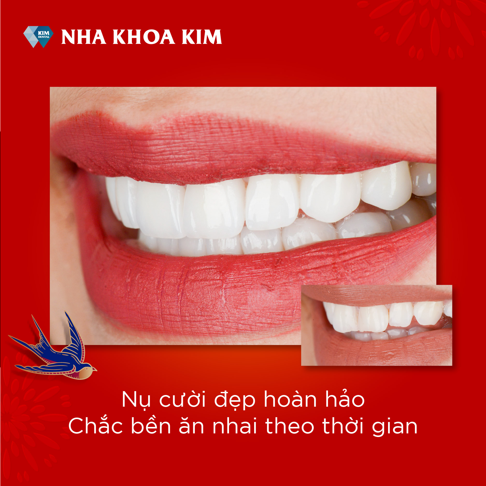 Nha Khoa Kim ảnh 2