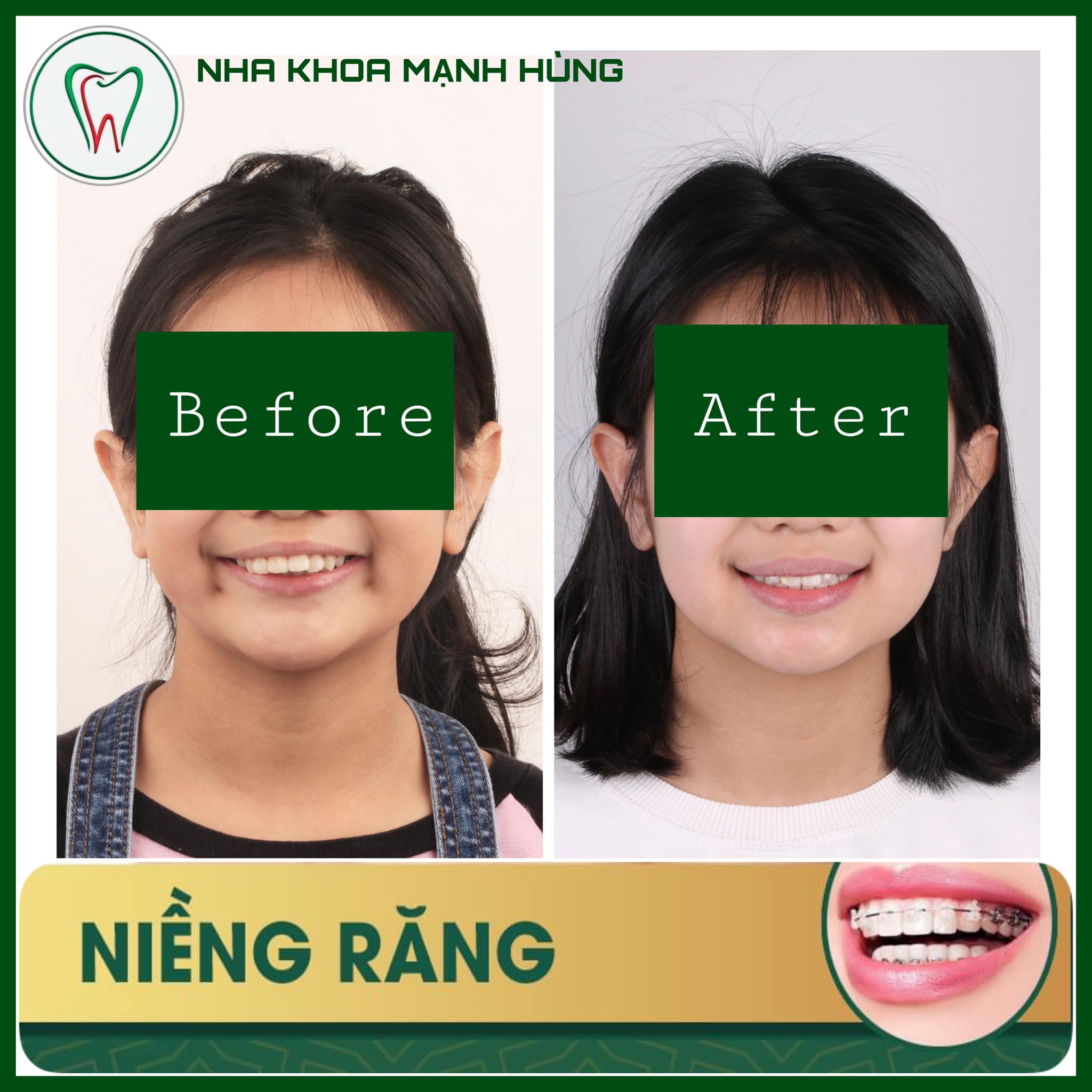 Nha Khoa Mạnh Hùng ảnh 2