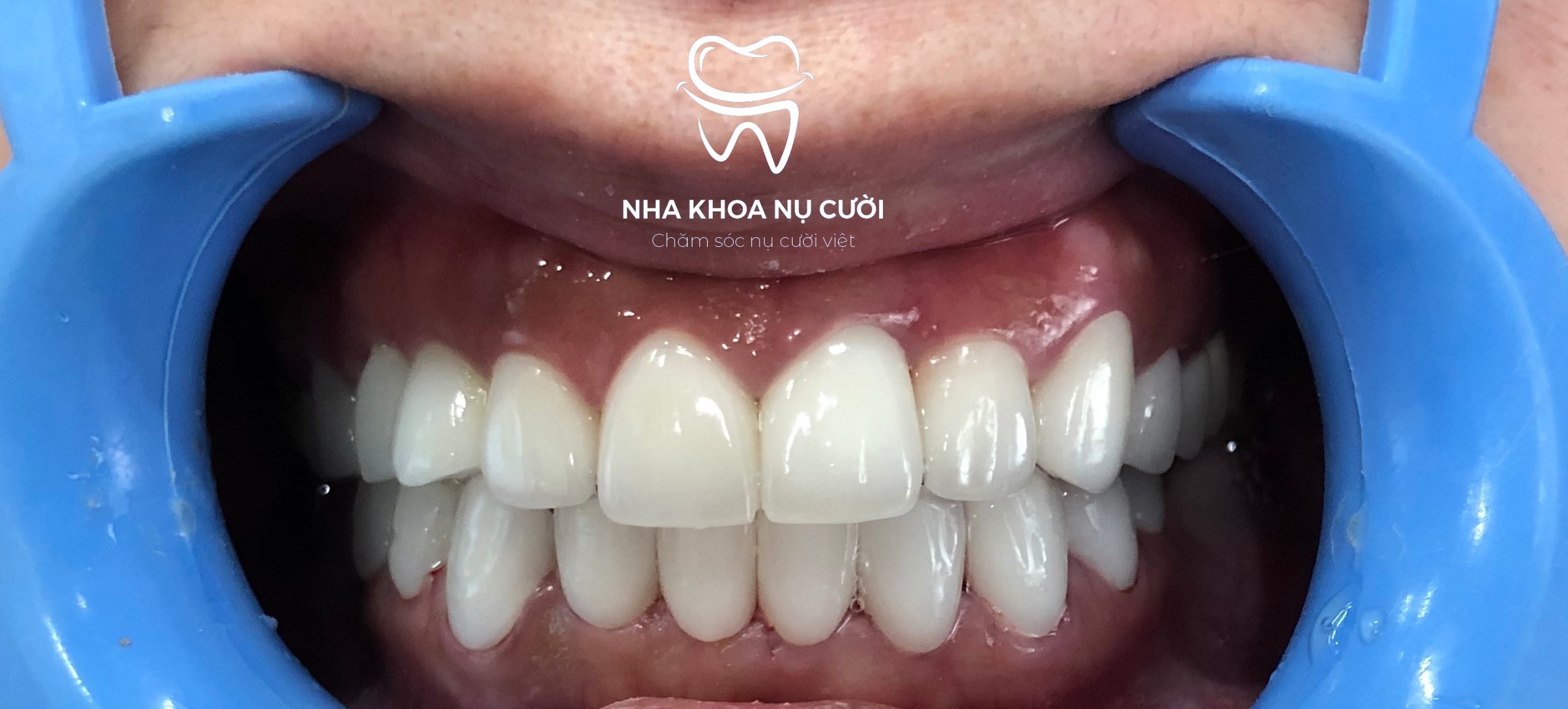 Nha Khoa Nụ Cười Đà Lạt ảnh 2