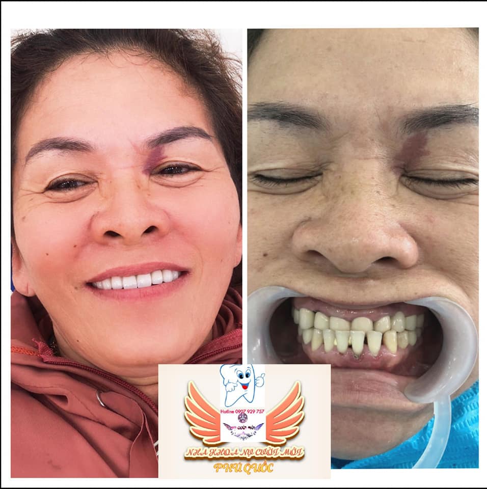Nha Khoa Nụ Cười Mới Phú Quốc ảnh 1