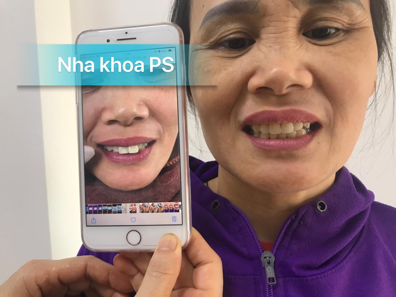 Nha Khoa PS Hưng Yên ảnh 1