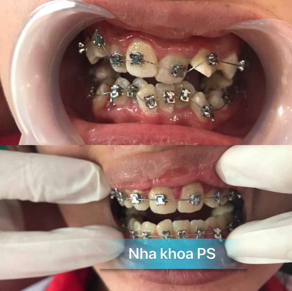 Nha Khoa PS Hưng Yên ảnh 1