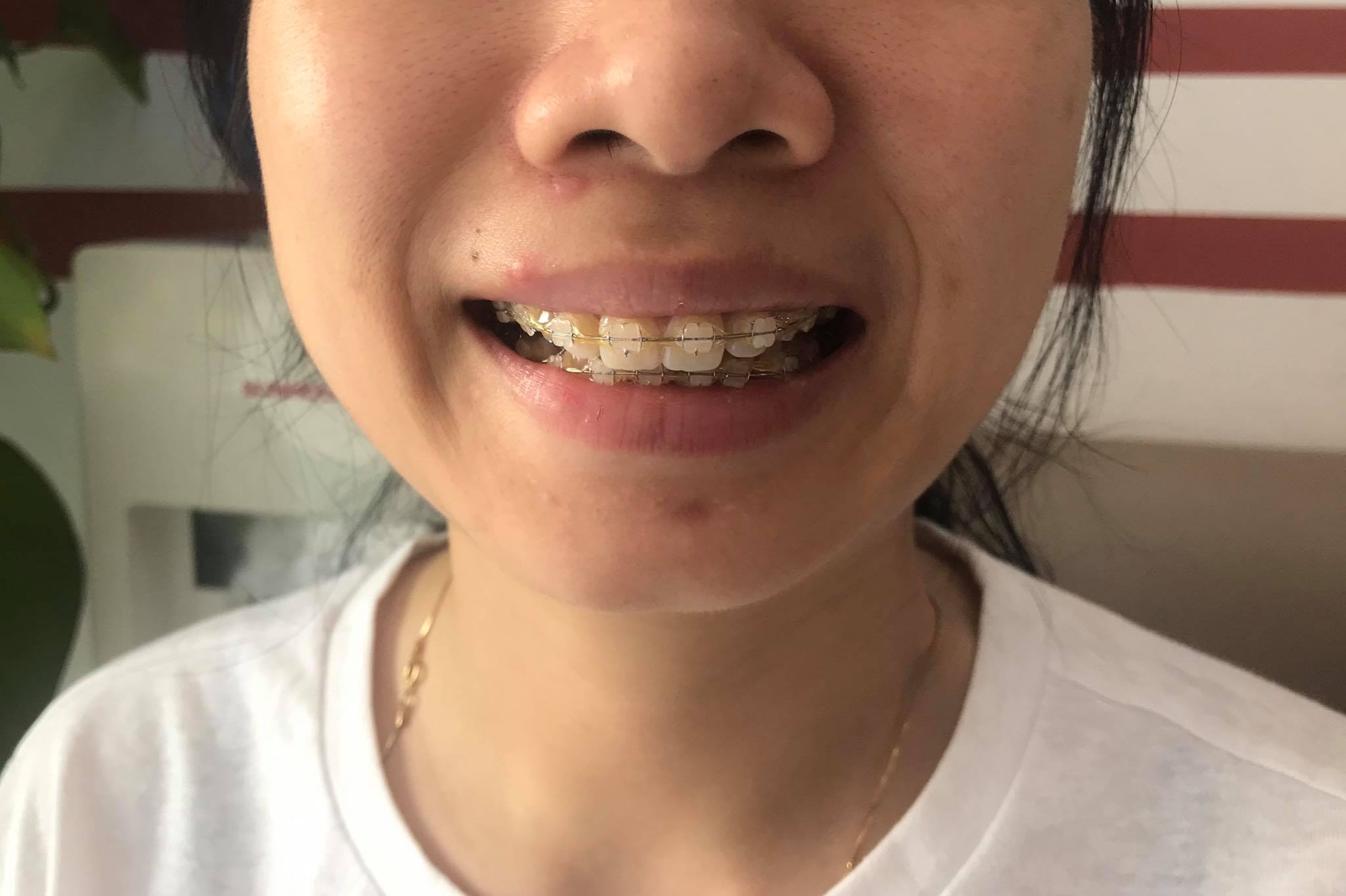 Nha Khoa PS Hưng Yên ảnh 2