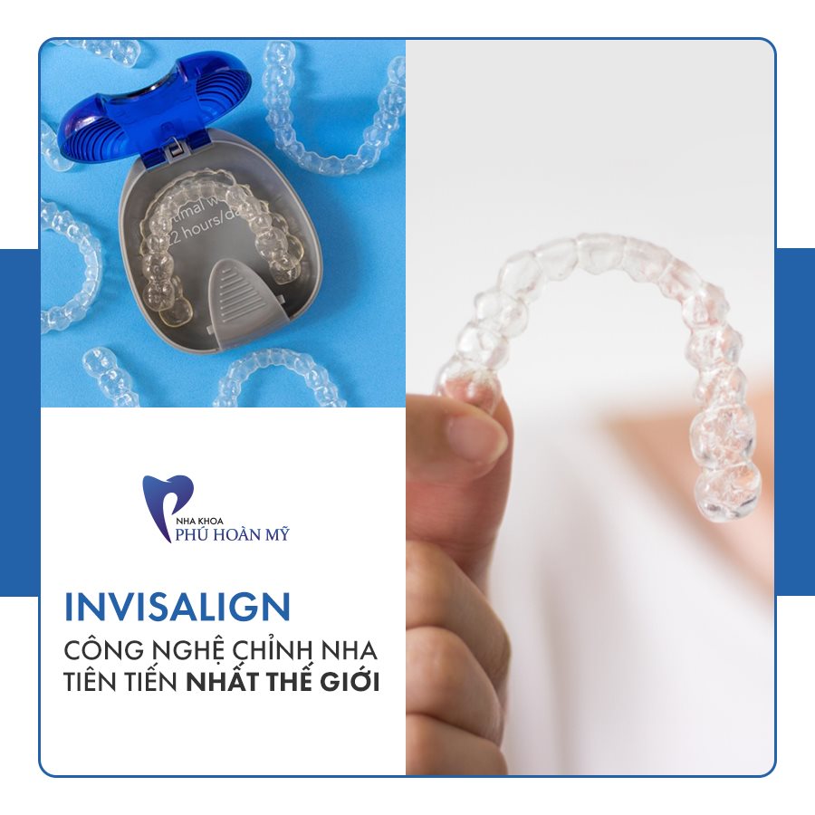 INVISALIGN- công nghệ chỉnh nha tiên tiến nhất thế giới được Nha Khoa Phú Hoàn Mỹ áp dụng trong kỹ thuật niềng răng ảnh 2