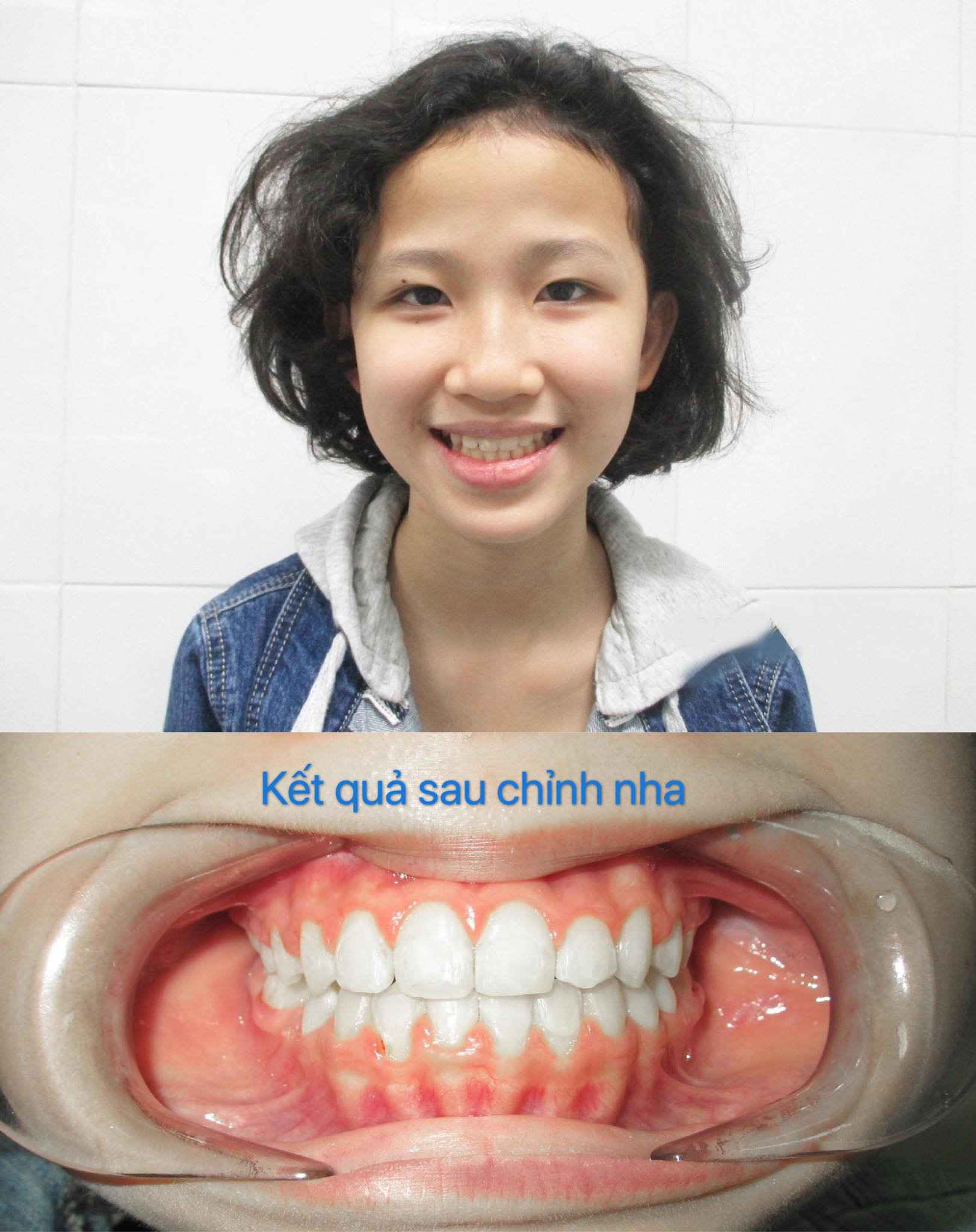 Nha Khoa Phú Hoàn Mỹ TP Huế ảnh 3