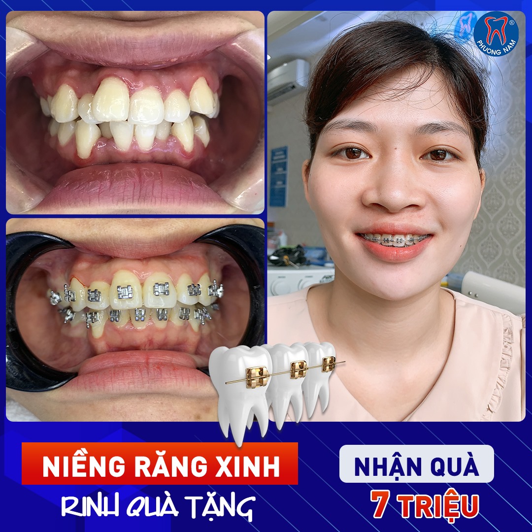 Nha Khoa Phương Nam - Chi nhánh Tuyên Quang ảnh 1